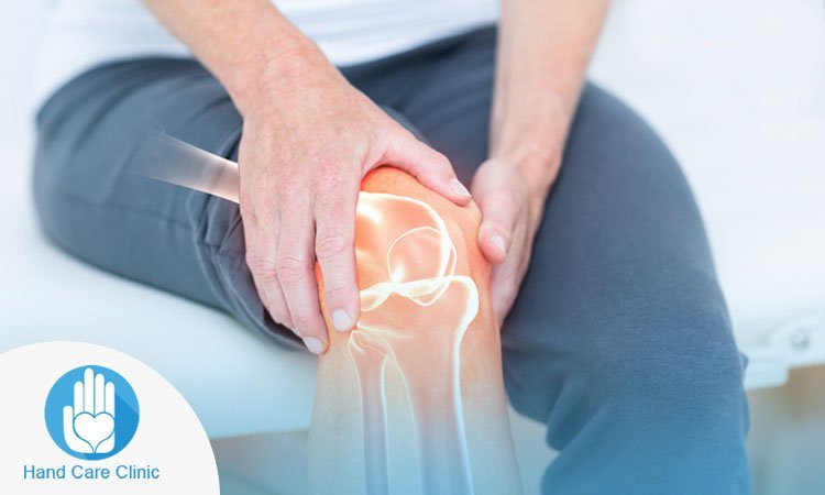 علاج التهاب المفاصل الركبة