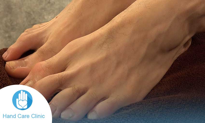 علاج تنميل اصابع الرجلين