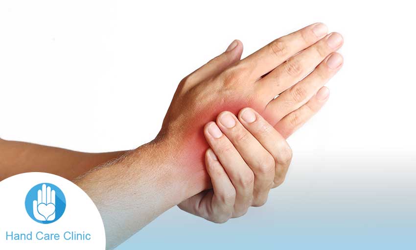 اسباب تورم اليدين