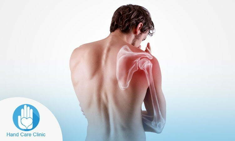 اعراض خلع الكتف