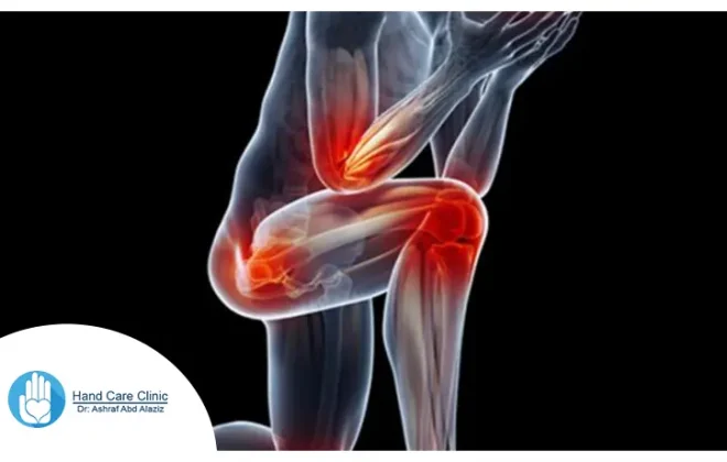افضل علاج لالتهاب المفصل الحرقفي العجزي