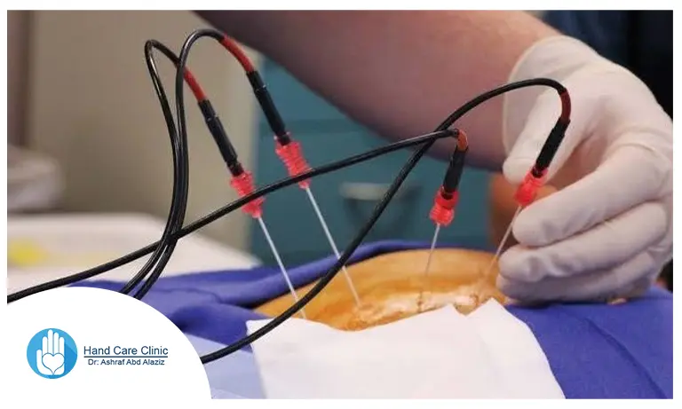 ماهو التردد الحرارى