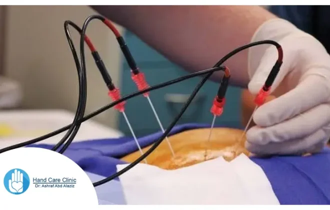 ماهو التردد الحرارى