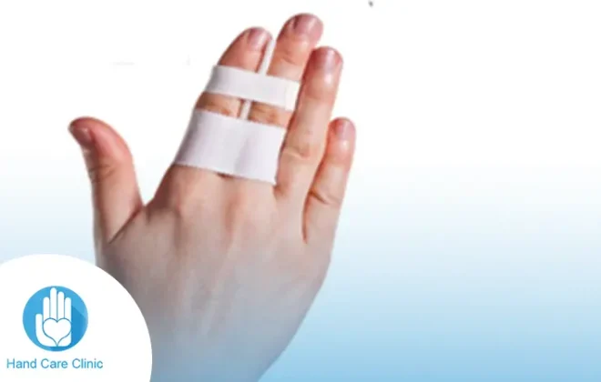 أعراض كسر الاصبع