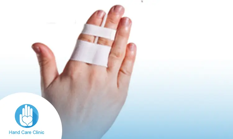 أعراض كسر الاصبع