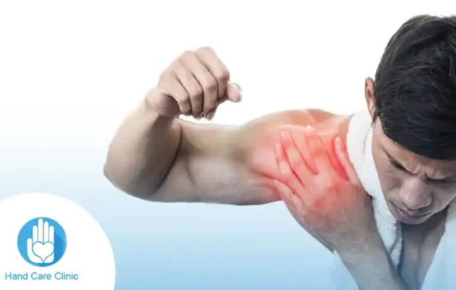 التهاب اوتار الكتف