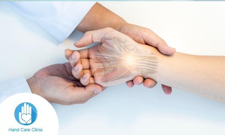 أفضل علاج لالتهاب المفاصل