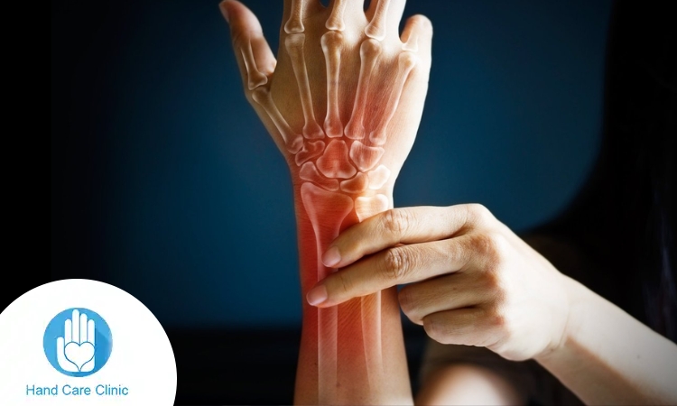 نخر عظام اليد