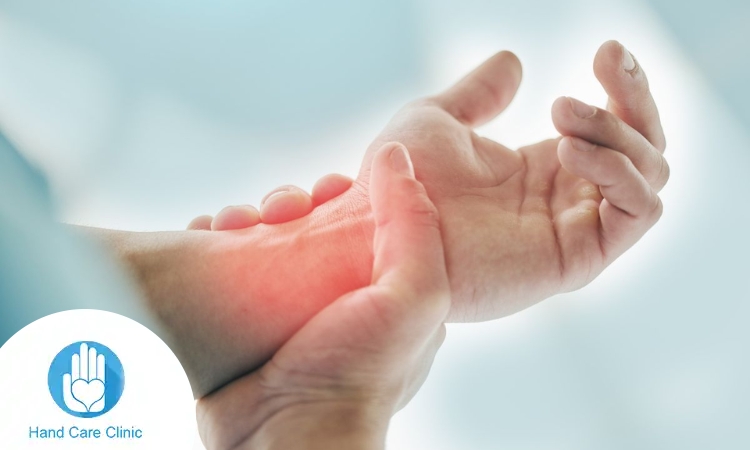 علاج التهاب الأعصاب في اليد