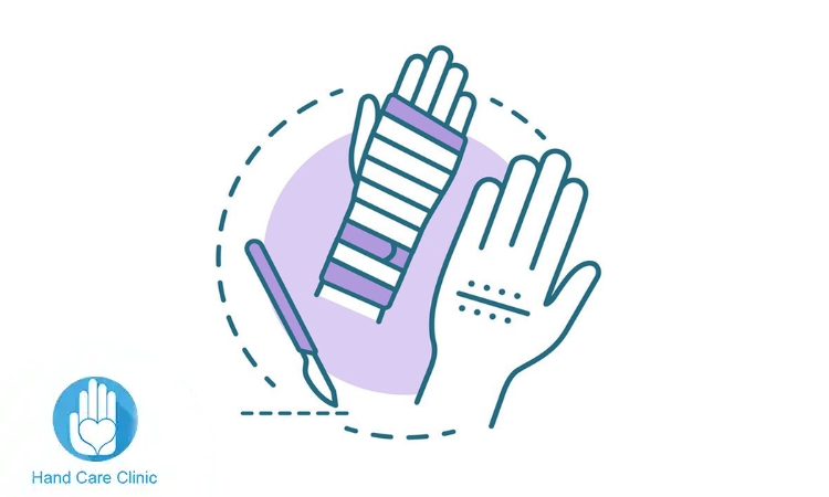 مركز جراحة اليد والجراحات الميكروسكوبية