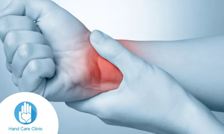 علاج التهاب المفاصل عند النساء