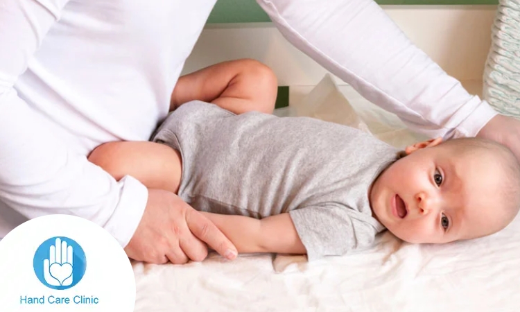 شلل إرب عند الأطفال حديثي الولادة