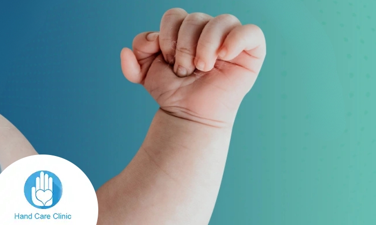 علاج تشوهات اليد عند الأطفال