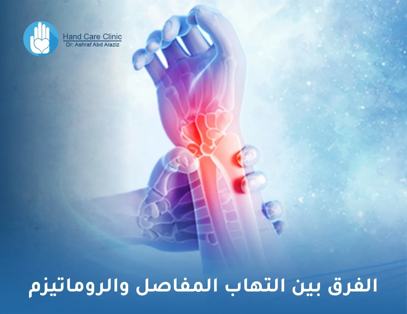 الفرق بين التهاب المفاصل والروماتيزم
