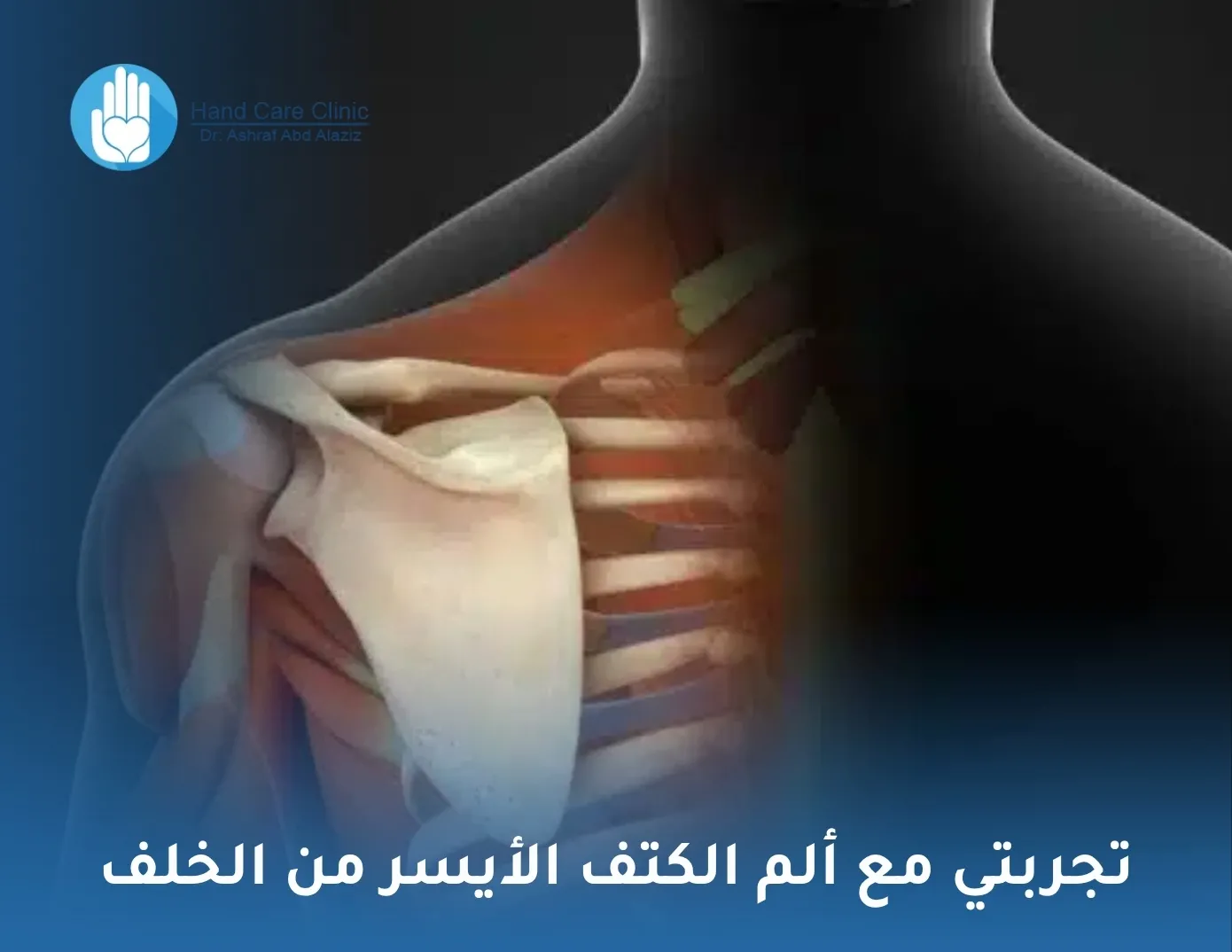 تجربتي مع ألم الكتف الأيسر من الخلف