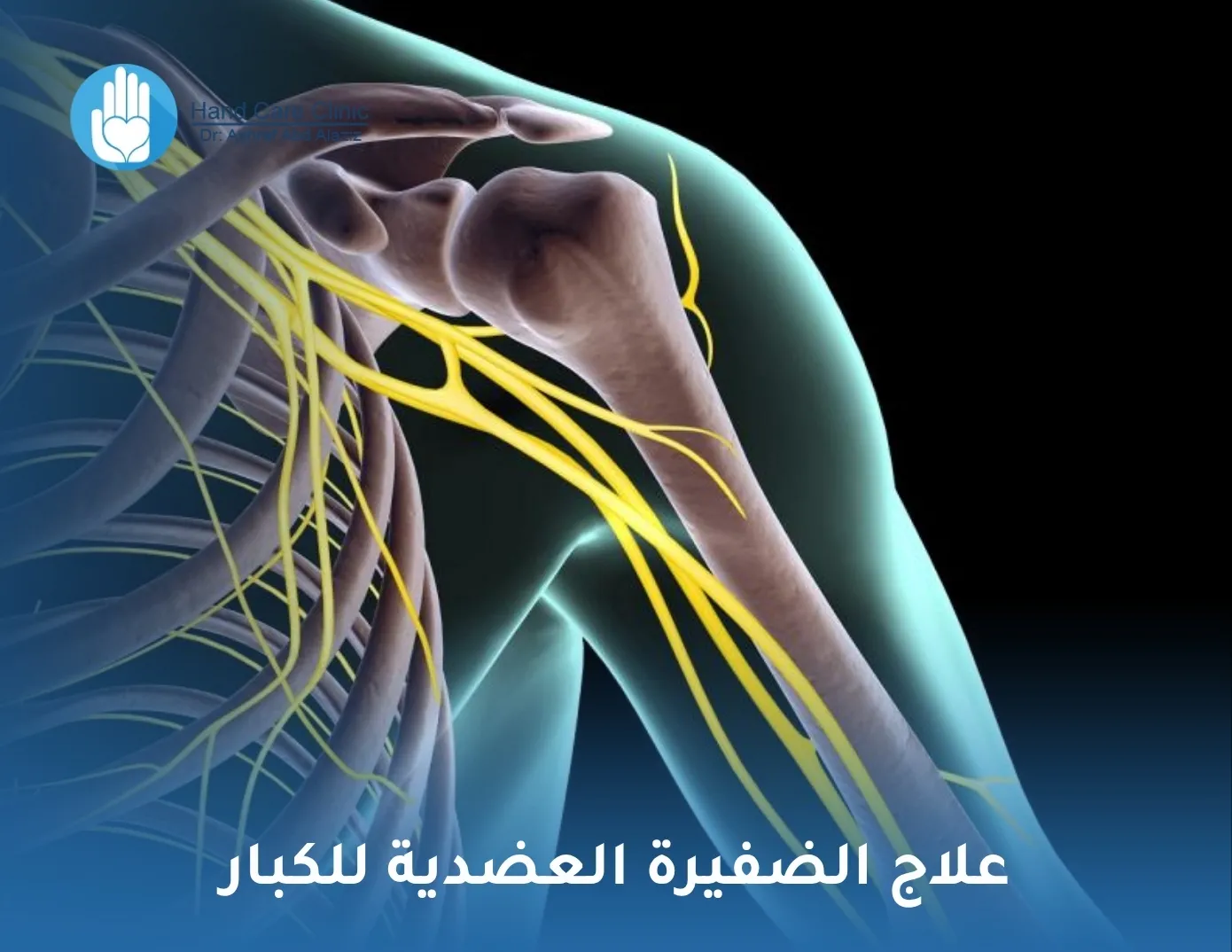 علاج الضفيرة العضدية للكبار