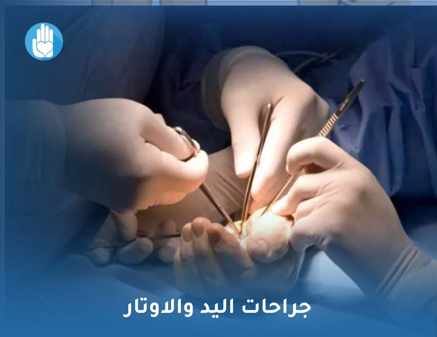 جراحات اليد والاوتار