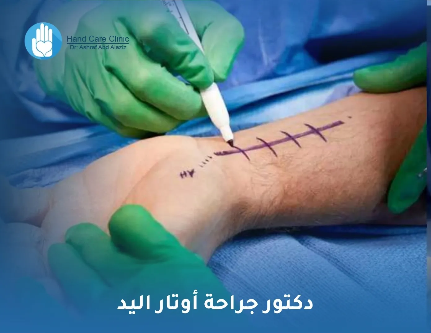 دكتور جراحة أوتار اليد