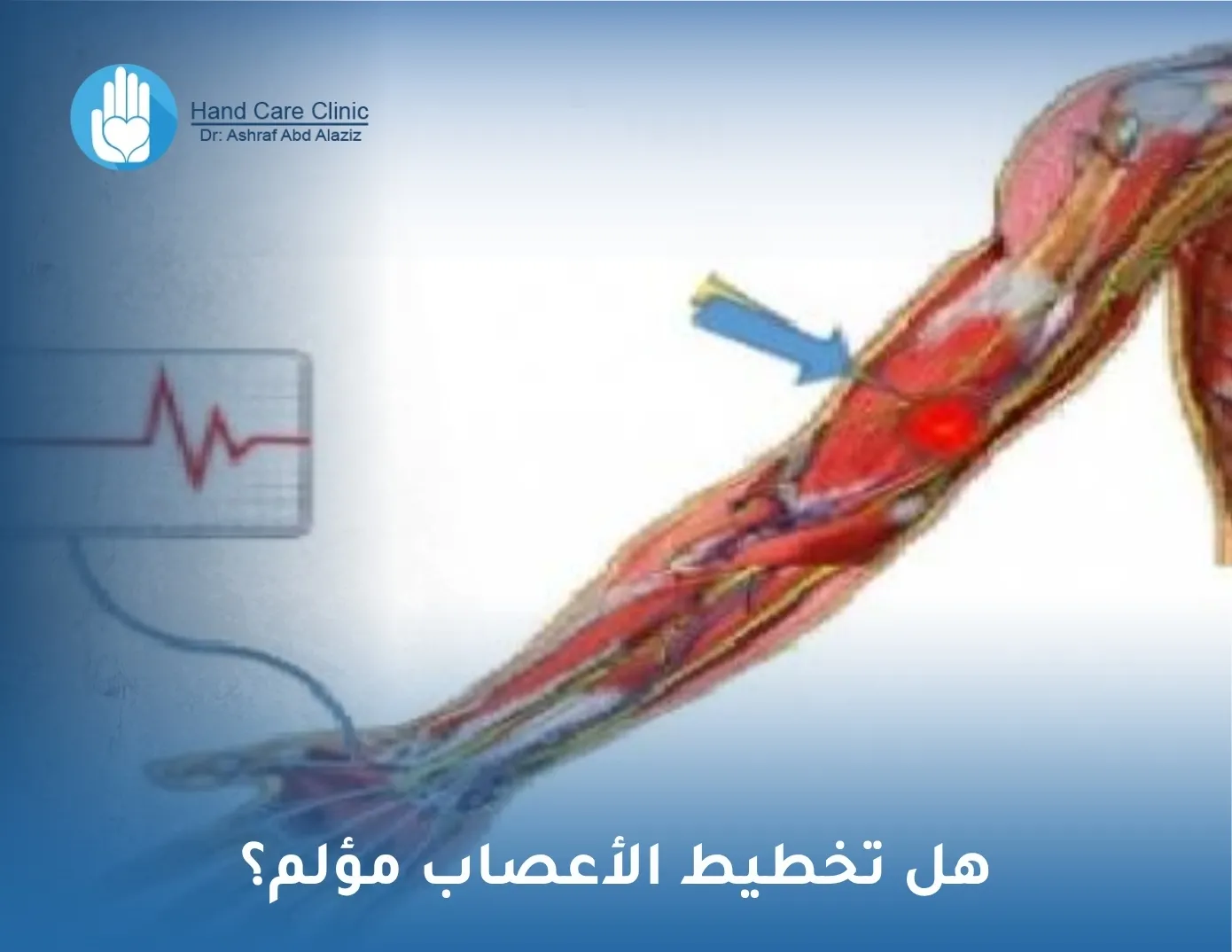 تخطيط الأعصاب مؤلم