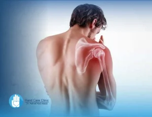 علاج شلل إرب للكبار