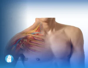 أعراض الضفيرة العصبية