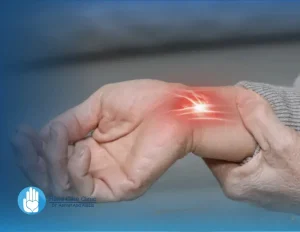 دكتور جراحة أوتار اليد