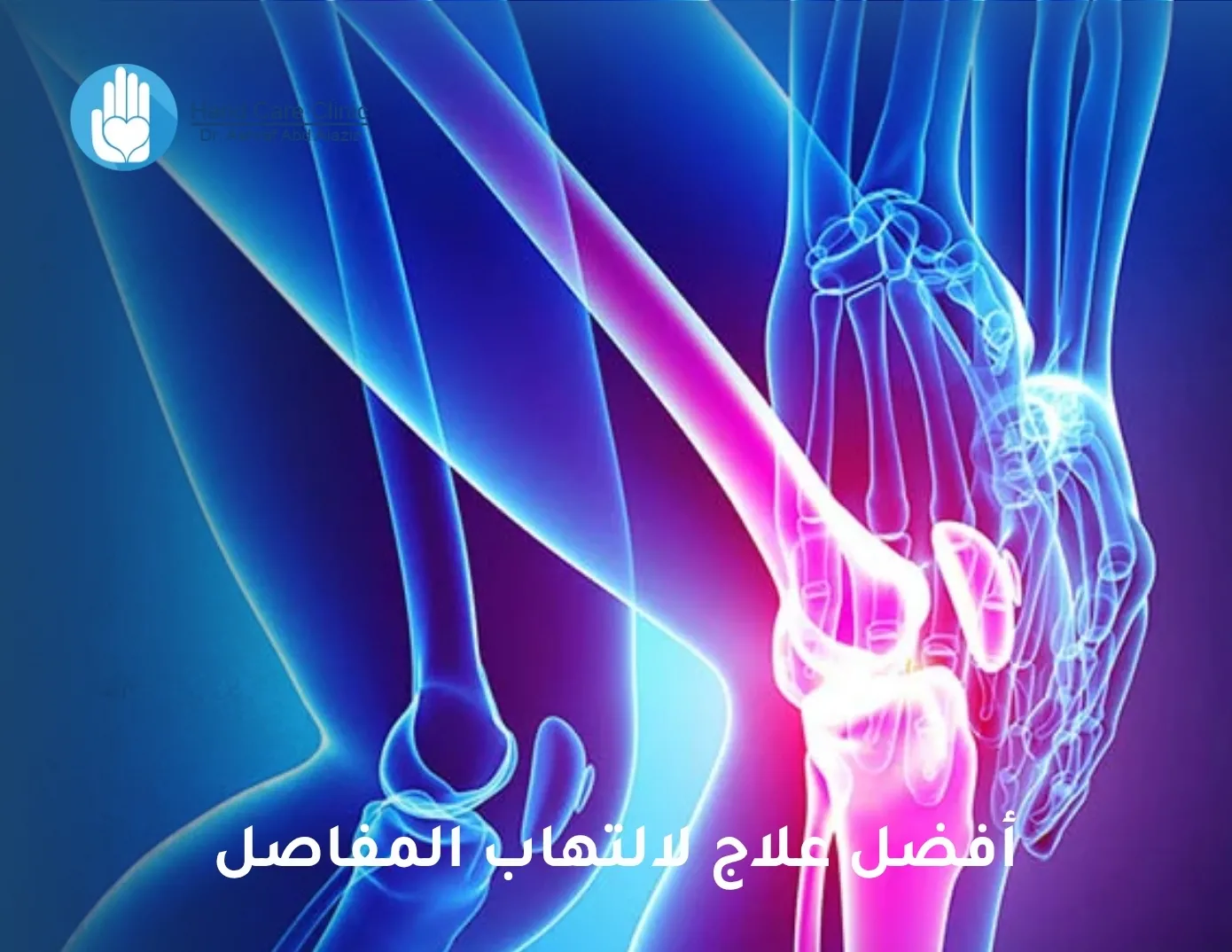 أفضل علاج لالتهاب المفاصل