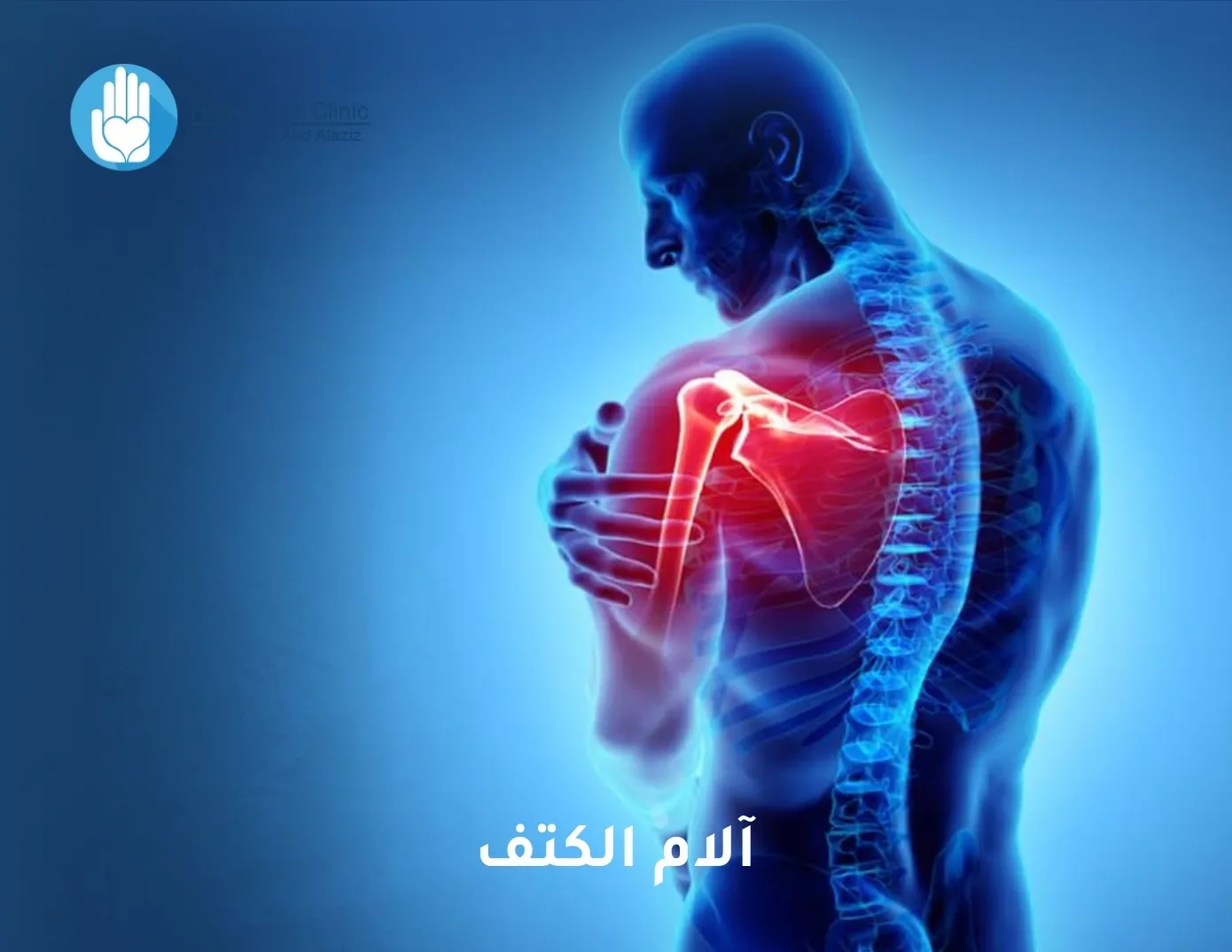 آلام الكتف
