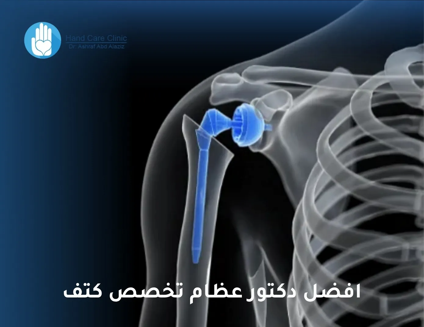 افضل دكتور عظام تخصص كتف