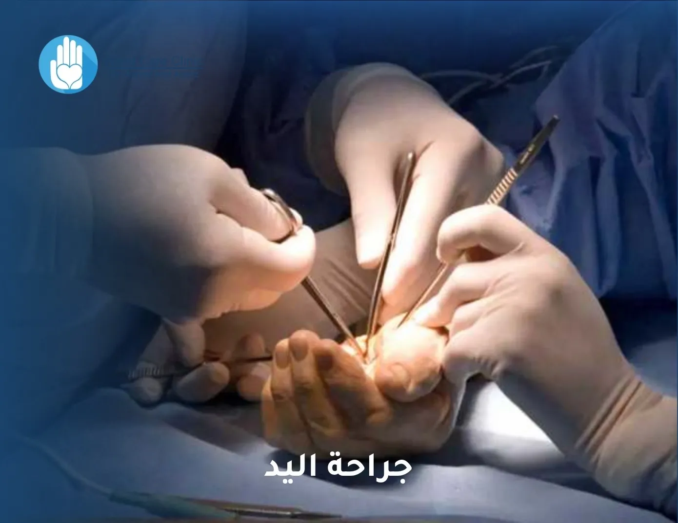 جراحة اليد