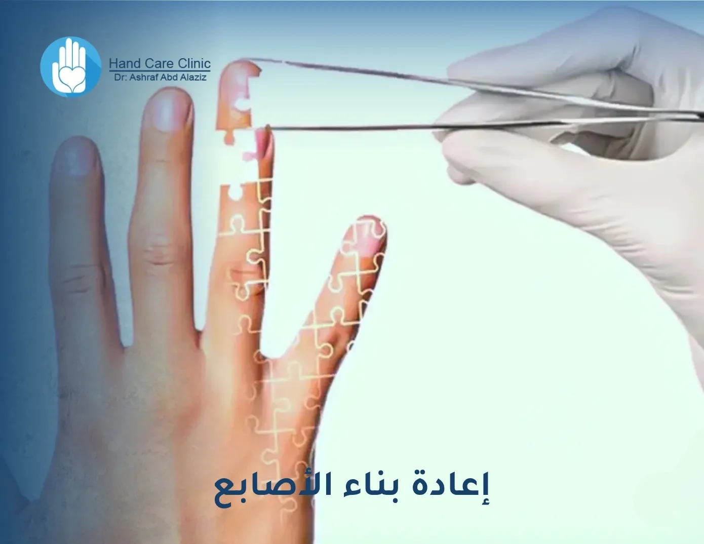 إعادة بناء الأصابع