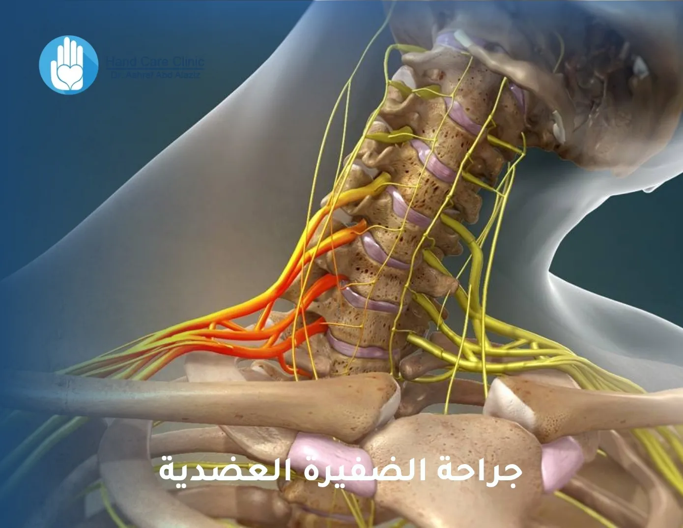 جراحة الضفيرة العضدية