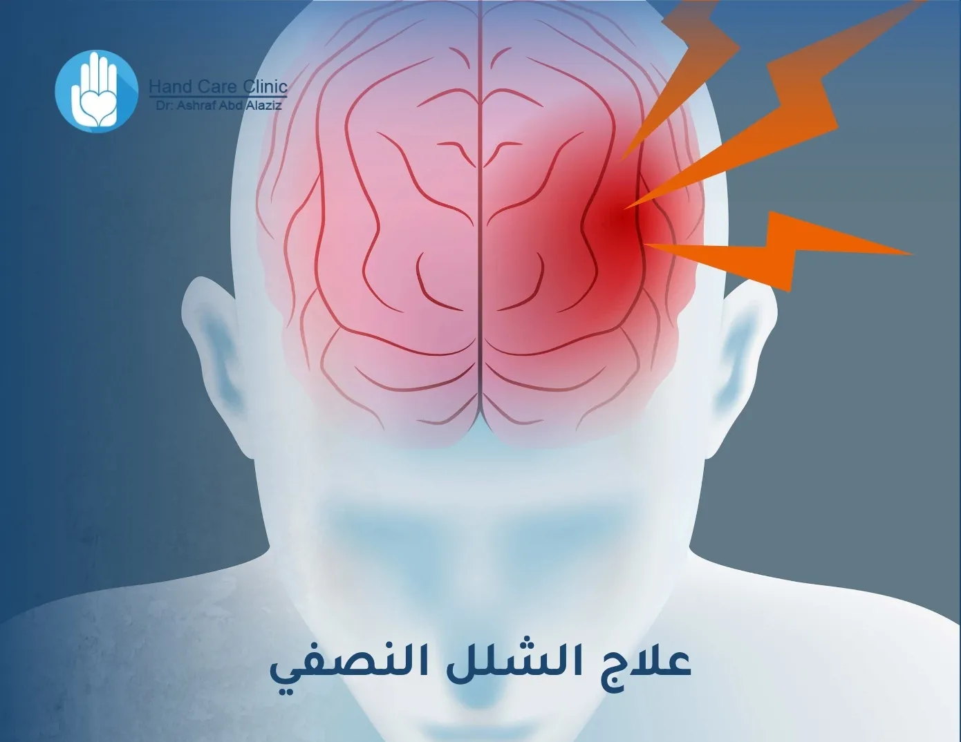 علاج الشلل النصفي