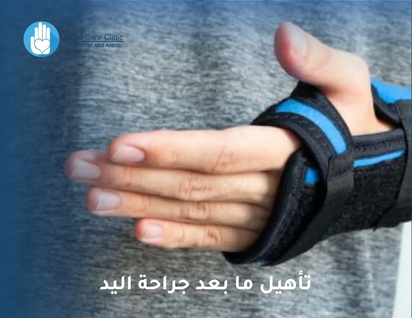 تأهيل ما بعد جراحة اليد